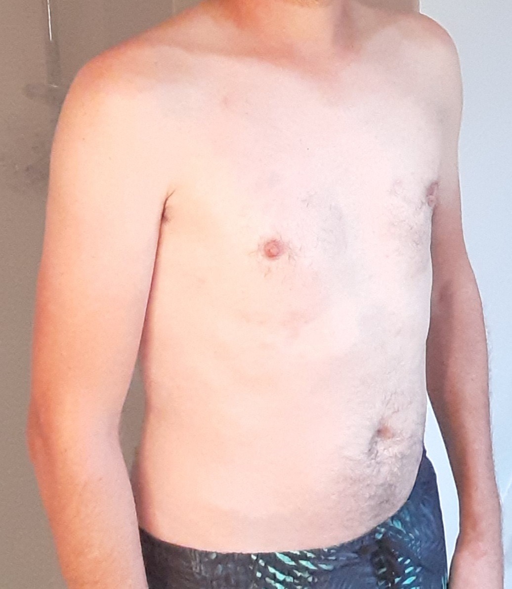 Amalio - Pepinster - Liège | Rencontre gay